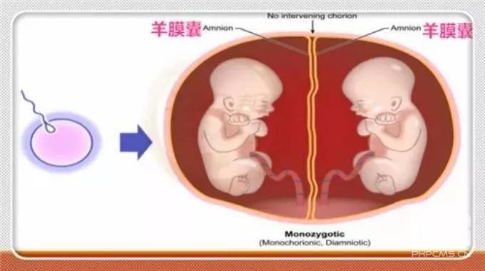 任何一个36岁的姐妹怀了双胞胎，我的，赠卵试管婴儿，其他