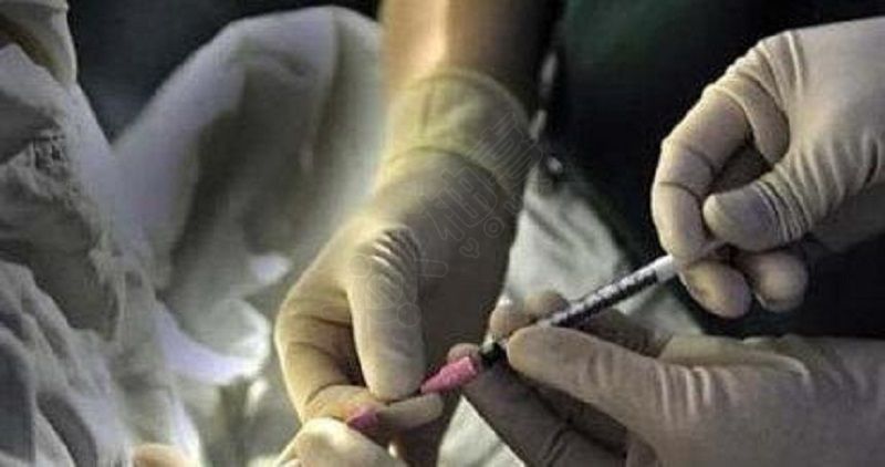 借卵试管婴儿定方案当天要检查什么