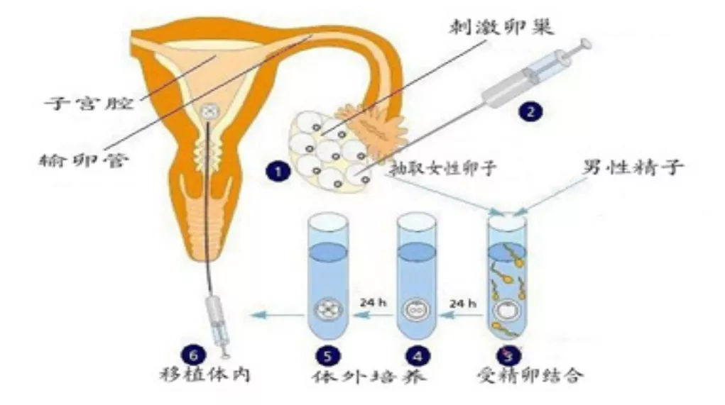 做借卵试管婴儿一般多少钱