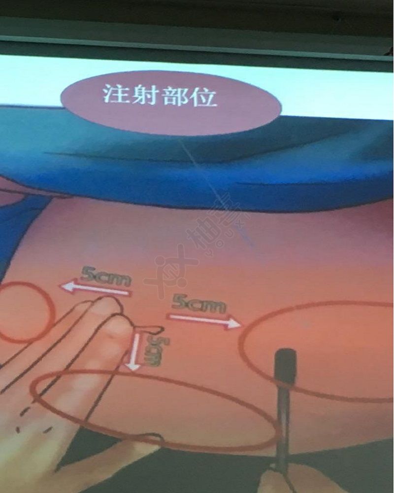上海供卵公司上海i价目表