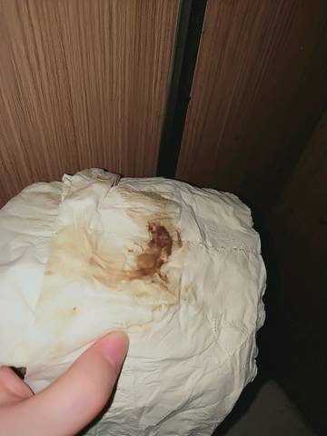 做了赠卵试管婴儿会提前闭经吗