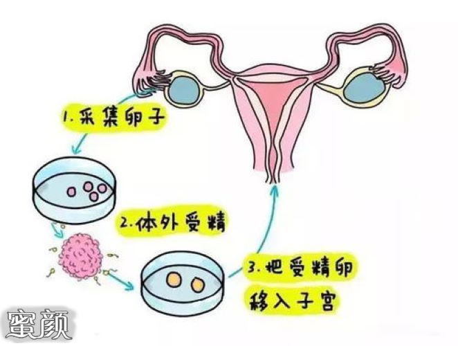 卵巢早衰照样能代生套餐选性别婴儿如何提高成功率、费用多少