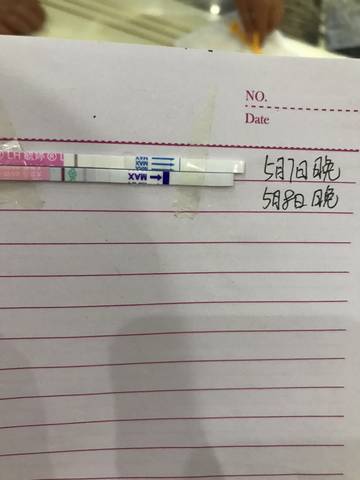 卵泡在左侧姿势受孕