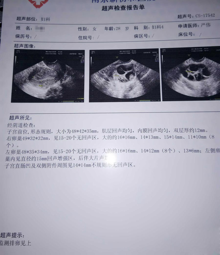 人工筛选xy精子价格公布,国内、国外收费标准大有不同