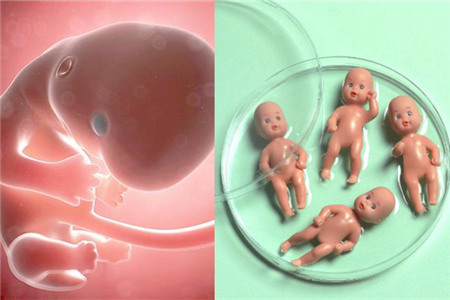 子宫内膜增生症导致不孕症的辨证论治